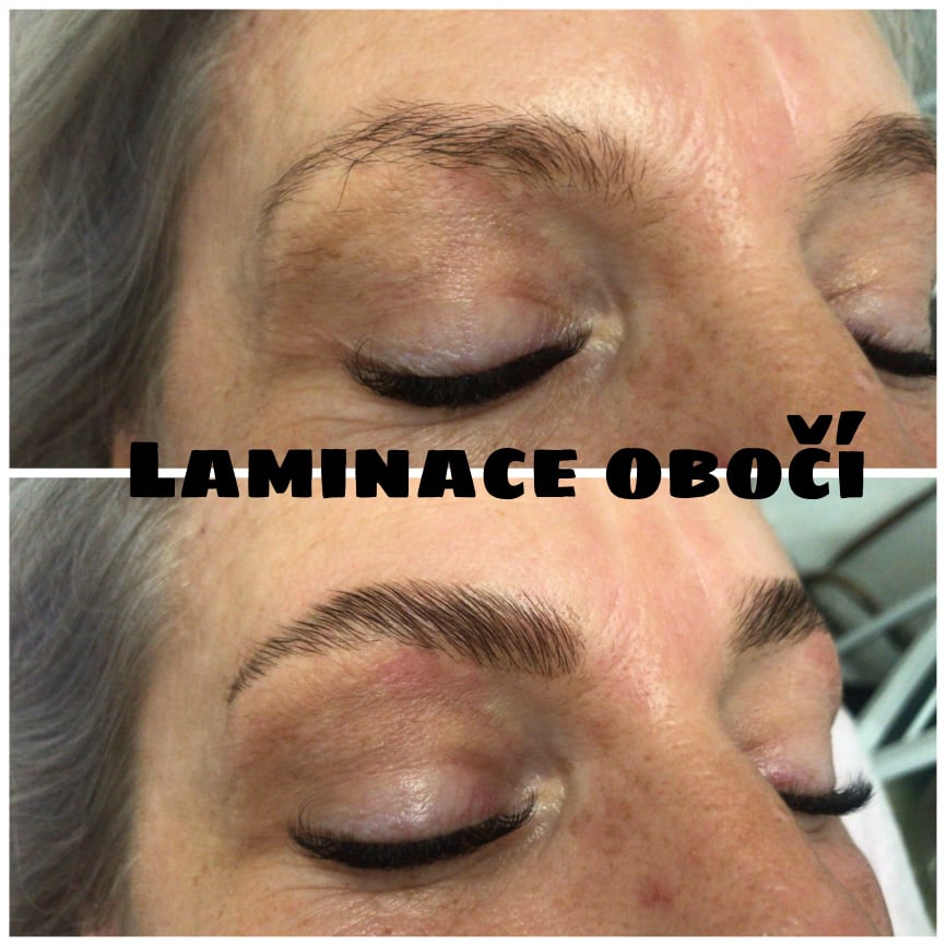 laminace obočí